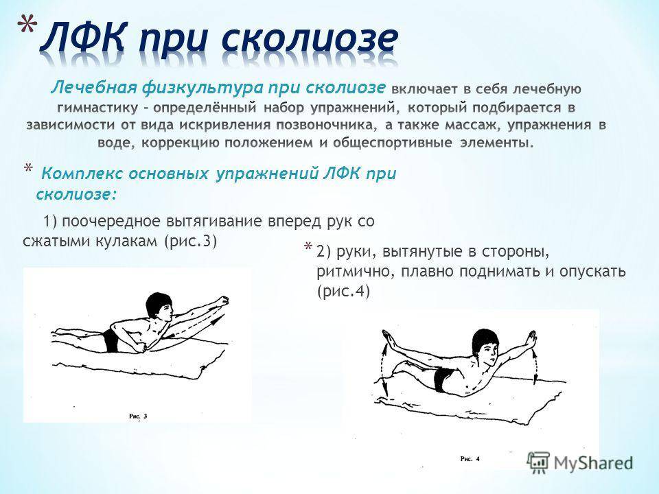 Упражнения от сколиоза для детей в домашних условиях: зарядка для позвоночника