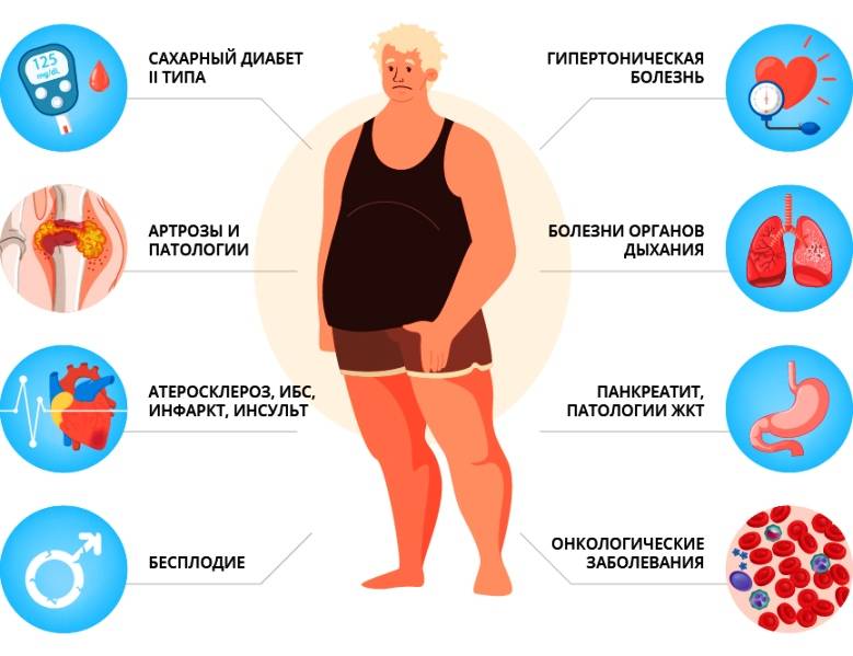 Ожирение (лишний вес) у детей и взрослых: причины, лечение и степени ожирения - напоправку – напоправку