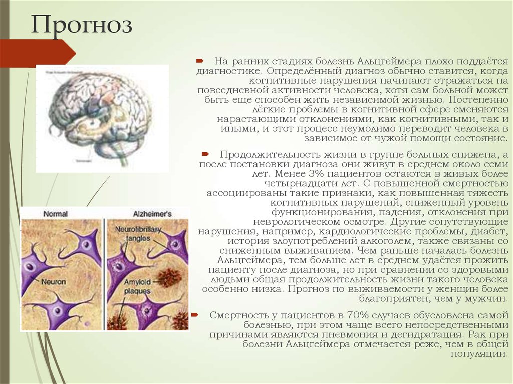 Симптомы заболевания альцгеймер