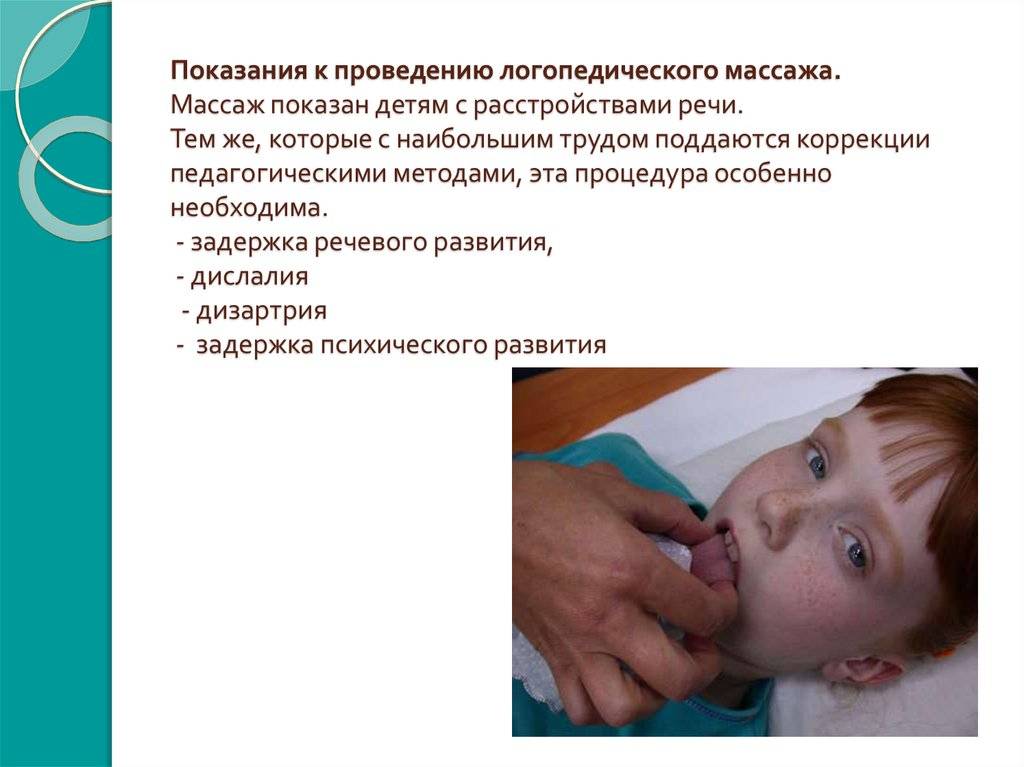 Логопедический массаж: для чего нужен и как правильно делать - parents.ru | parents