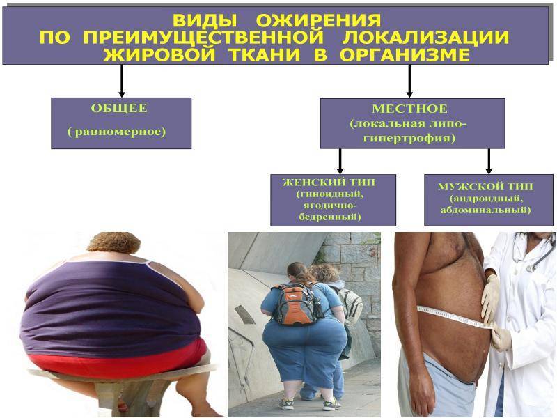 Алиментарное ожирение - что это, причины, симптомы, лечение